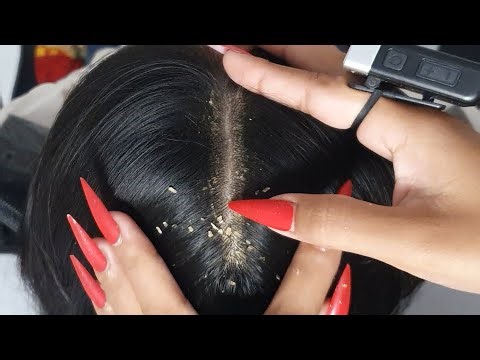 Deep Scalp Relief ASMR 🌙 | Slow Scratching, Flakes, Tingly Nail Sounds #VF0168