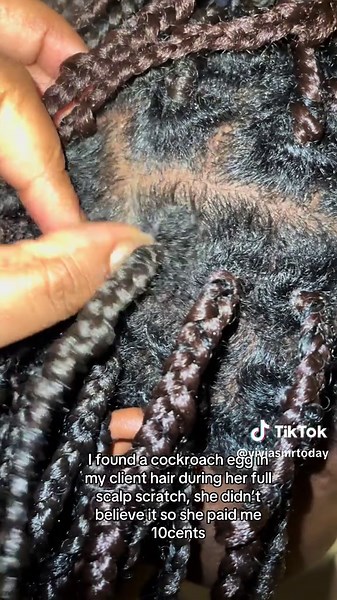 Discovering a Cockroach Egg During Scalp Treatment