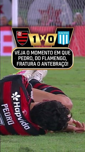PÉSSIMA NOTÍCIA PARA O FLAMENGO! 🚑😰 PEDRO SOFRE FRATURA NO ANTEBRAÇO DURANTE A PARTIDA... #shorts