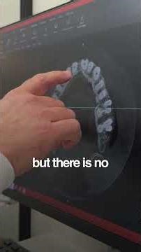 2D vs 3D X-Rays: Seeing the Invisible! 🦷 #shorts