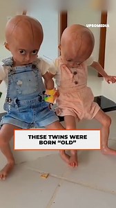 22K views · 369 reactions | Elis and Eloá were born wrinkled, they looked like mini old ladies, but behind that “tender” appearance was a terrible disease. Poor access to health care made their diagnosis difficult, but when they finally had it, there was no choice but to accept what was to come. | Vitamin | Facebook