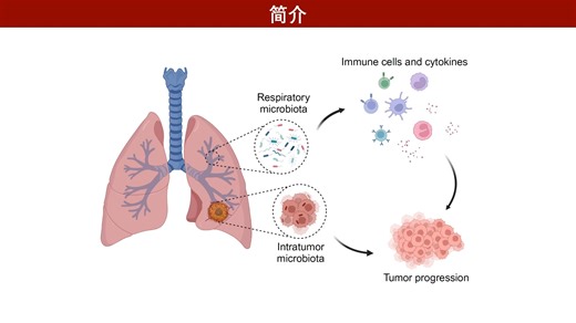 iMeta | 呼吸系统微生物群在肺癌发展中的作用及其临床应用