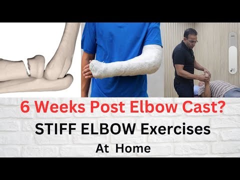 Exercises for Elbow Stiffness After 6 Weeks of Cast | Fix Elbow stiffness In 10 days at Home