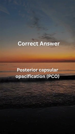 Posterior Capsule Opacification | Why Vision Drops Months After Cataract Surgery(MCQ)#ophthalmology