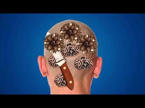 Man Head Back Infected Maggots | Removal Animation | ASMR Maggots Removal | Disprine ASMR