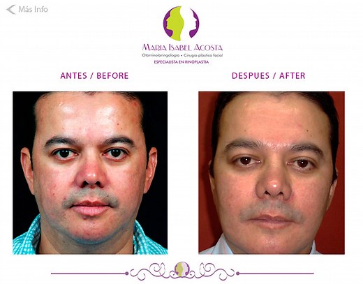 Cif Single Chip Driver For Windows 10