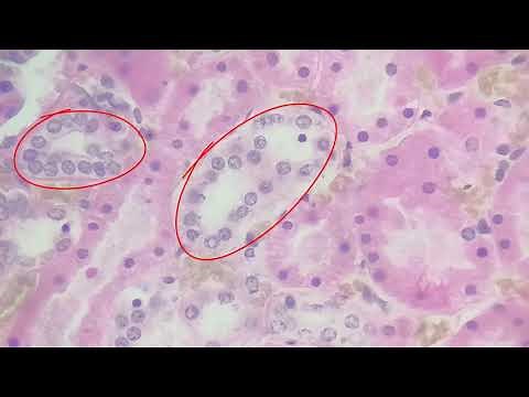 simple cuboidal epithelium