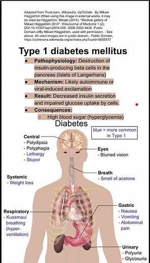 Type 1 diabetes mellitus