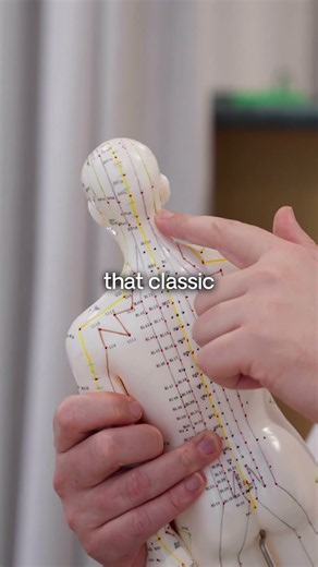 Acupuncture For Headaches