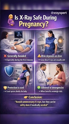 Is it safe to get an X-ray during pregnancy? 🤰⚠️ #fetalimaging #ultrasoundtesting #firstscan ”