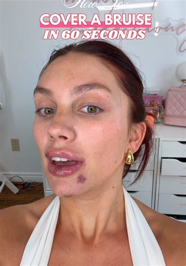 Cover Bruises in 60 Seconds with Color Theory