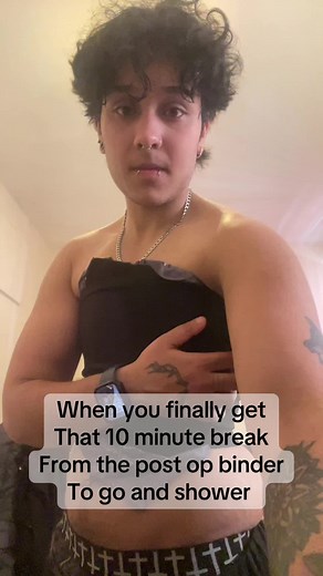 Post-op Binder Relief: How Long to Wear After Top Surgery