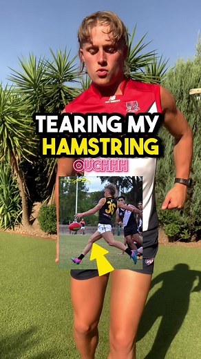 Rehabilitation Tips for Torn Hamstring | Effective Healing Methods