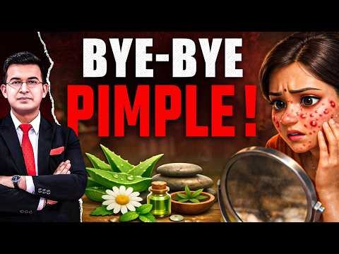 Never Pop Your Pimples! Avoid These Mistake! | Get Rid of Pimples! | Shubhankar Mishra