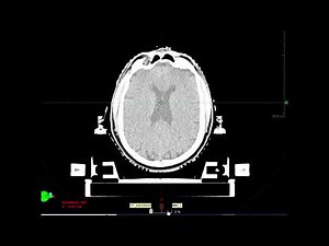 Image Registration Basics