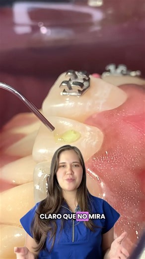 Braces installation #orthodontist #orthodontics #youtubeshorts #dentist #limaperu