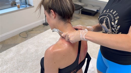 Something STRANGE Came Through Her Skin - Back Scraping Cleaned Out Major Gunk Was Released Online Shop! https://mondragonmerch.com/ | Mondragon Chiropractic