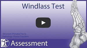 ANKLE/FOOT ASSESSMENT SERIES PART 14: WINDLASS TEST With the Windlass Test you can assess for plantar fasciitis, because you are provoking pain by stretching the fascia at its insertion at the base of the 1st metatarsophalangeal (MTP) joint. If you are not able to extend the MTP joint to at least 30°, we are talking about a hallux rigidus, which can be a reason why your patient is overpronating at the subtalar jont. #physio #physitutors #physiostudent #physiotherapeutassessment #physicaltherapy 