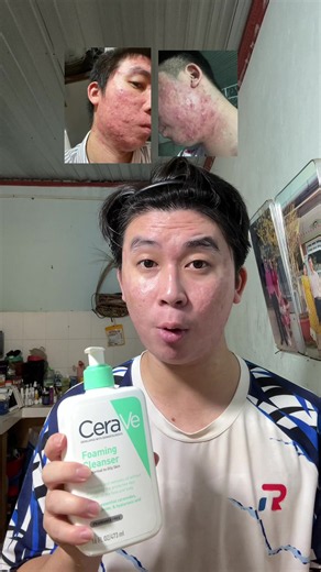 Sữa rửa mặt cho da dầu mụn nha cả nhà ơi #leannhien #leannhienreview #mụn #skincare #suaruamat