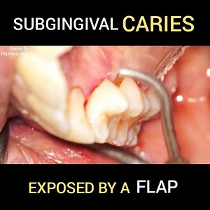 26K views · 410 reactions | Awesome Work.......... #Dentistry #Dental | Mind Dentistry | Facebook