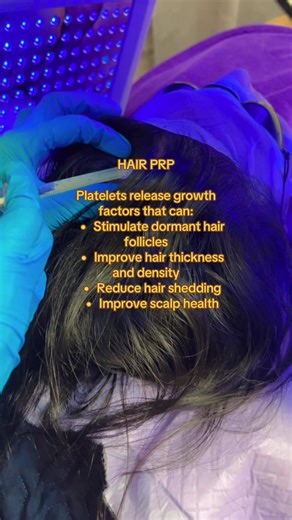 Platelets release growth factors that can: \t•\tStimulate dormant hair follicles \t•\tImprove hair thickness and density \t•\tReduce hair shedding \t•\tImprove scalp health NAK PUTIH? NAK KURUS? NAK SKIN TEGANG DAN NAMPKA MUDA? NAK KULIT CANTIK & GLOWING? CONTACT KITA SEKARANG!!! 📲 6013-6633901 #foryou #glowing #whiteningdrip #fyppppppppppppppppppppppp #viral