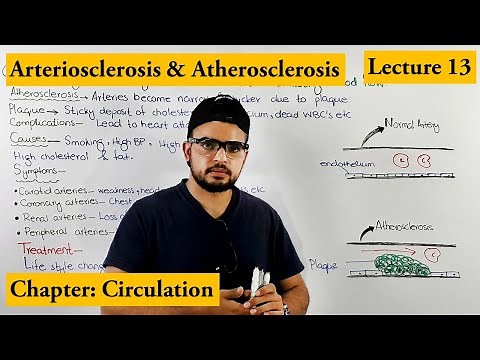 Arteriosclerosis & Atherosclerosis (CardioVascularDisorder) | Chapter circulation Video # 13