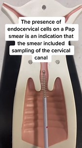9.9K views · 28 reactions | #pap #papsmear #smeartest #midwifemama #ob #gyn #test #pelvic #EatFreshRefresh | MidwifeMama | Facebook