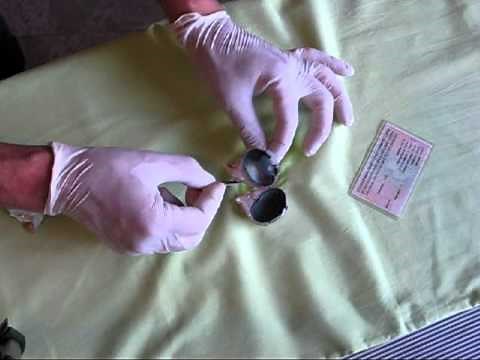 DISECCION OJO DE VACA