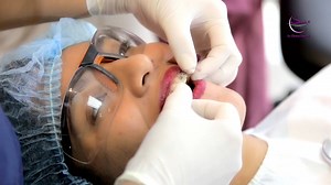 18K views · 49 reactions | #TestimoniosSmile Nuestros clientes dan testimonio de como están transformando su sonrisa a una sonrisa perfecta ¿Que esperas para hacerlo tu también? solo en Smile Design Su Clínica Dental, estamos ubicados en la Jose Padilla N34 E e Iñaquito edificio Platinum planta baja Quito Ecuador ¡Te esperamos! | Smile Design | Facebook