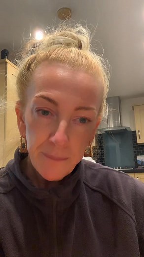 I hope this answers your questions no I haven’t had them💉 #notachance | Scouse bitch bible