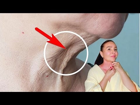 TURKEY NECK? How to tighten saggy neck skin with massage | Self massage