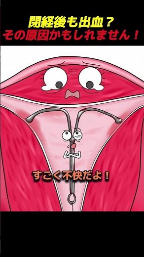 閉経後も出血？その原因かもしれません！