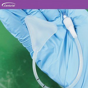 [Hot Item] Medical Disposables Silicone Balloon Uterine Stent Hemostasis