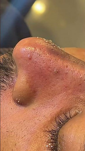 استمتع بالراحة والصفاء مع تقنيات تنظيف البشرة الاحترافية #𝟓𝟓𝟔𝟑𝟔