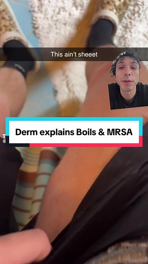 Quick minute education on #boils #mrsa #derm #dermatologist #dermatology #doctorsoftiktok #tiktokdoc @♠️🪶 𝙷𝙰𝚄𝚃𝚂𝙺𝚈 🪶♠️ #greenscreenvideo