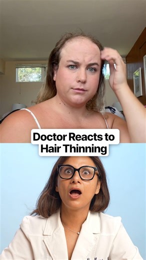 Hair loss patterns matter more than people think! 👀 #hairloss