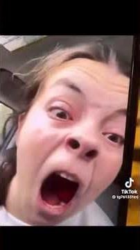 Post wisdom teeth hall of fame worthy #tiktok #shorts