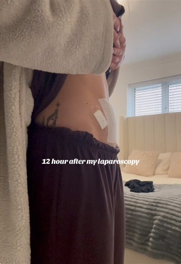 Understanding Laparoscopy for Endometriosis Awareness