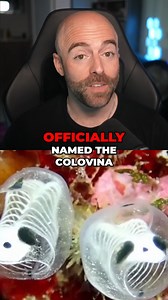 Basketball Nightmare: Player's Eye Pops Out, Incredible Recovery! | Matthew Santoro