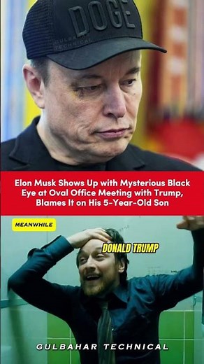Elon Musk’s Black Eye Sparks Viral Speculations! 🌪️
