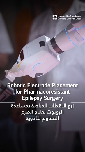 For patients with complex, drug-resistant epilepsy, precision matters. Robotic-assisted SEEG is helping our teams pinpoint seizure origins more accurately, shaping safer, more personalized treatment plans. Proud to lead the UAE’s first robotic-assisted SEEG procedure. To learn more about our Epilepsy Program, visit the link: https://www.clevelandclinicabudhabi.ae/en/institutes-and-specialties/neurological/epilepsy في حالات الصرع المقاوم للأدوية، تمثل الدقة خطوة أساسية لتحقيق أفضل النتائج العلاجي