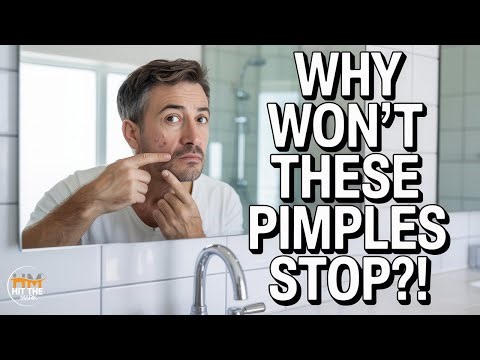 Why I Still Get Pimples at 60 and How to Finally Fix It
