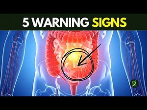 Is Your Body Showing These 5 Colon Cancer Signs?