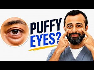 THIS Is How You Get Rid of Puffy Eyes!