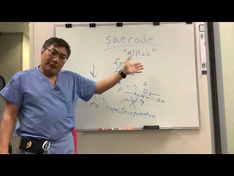 Saccade Abnormalities