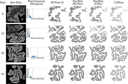 Deep learning-based localization algorithms on fluorescence human brain 3D reconstruction: a comparative study using stereology as a reference - Scientific Reports
