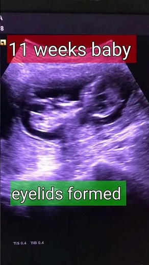 How do babies 👶 eyes develop/ baby start seeing/shortvideo shorts