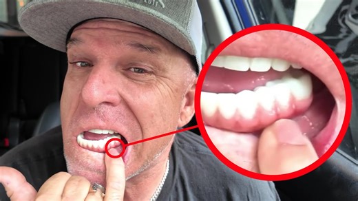 You gotta be aware of the gap. - - - - - - - How Much Do Dental Implants Cost?? Find out NOW: https://bit.ly/3Igh9EX 60-Second Eligibility Quiz: https://bit.ly/3VWhTlD | Nuvia Dental Implant Center