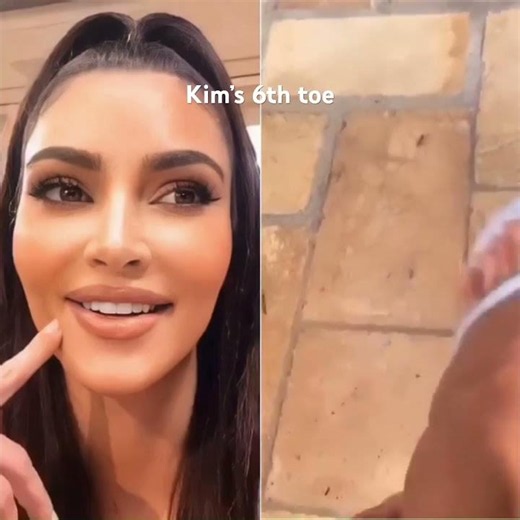 Unintentional ASMR | Kim’s 6th toe