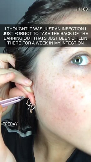 Moral of the story take the backs of ur earrings out | earring backs